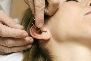Auricular Therapy