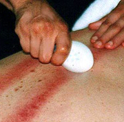Gua Sha