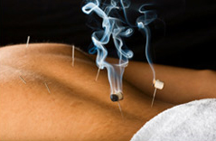 Moxibustion